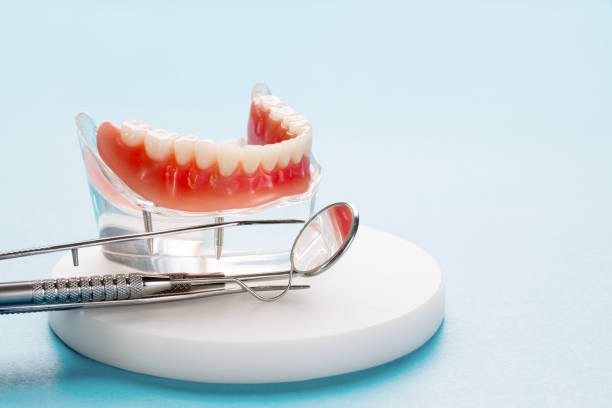 Dental Bonding in Urbana, MD